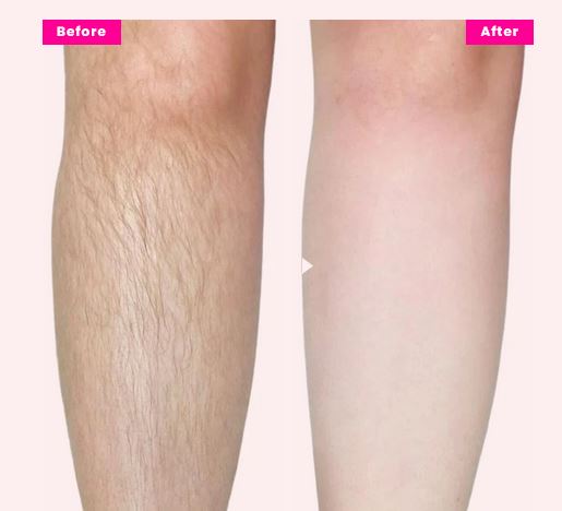 Lisse Painless Cream Wax Pink - 400ml
